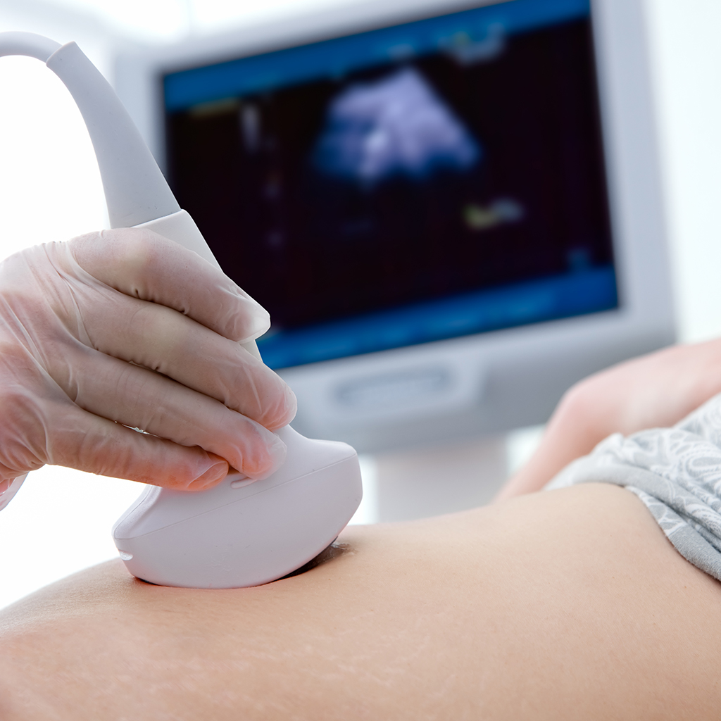 difference between 3d and 4d ultrasound